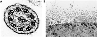 Identification of a novel RPGR mutation associated with retinitis pigmentosa and primary ciliary dyskinesia in a Slovak family: a case report